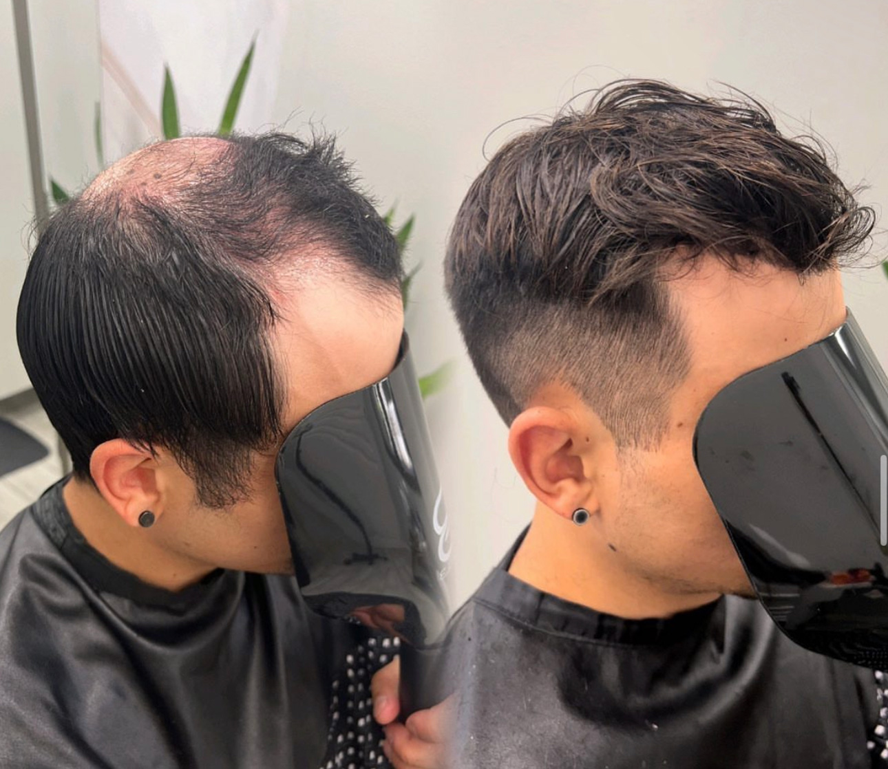 Men's hair system before-and-after result with dark styled hair